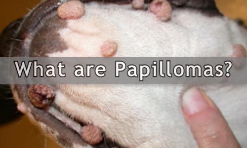 What are Papillomas